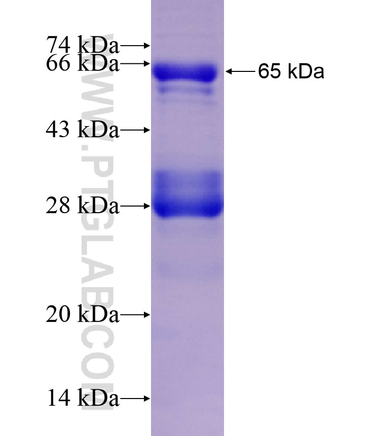 DCPS fusion protein Ag8726 SDS-PAGE