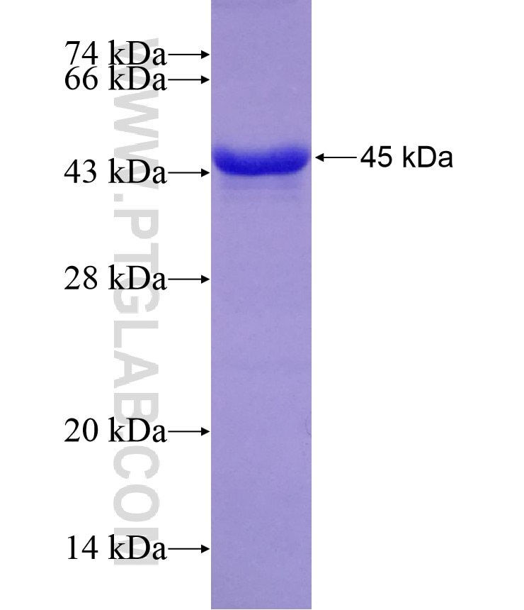 DCPS fusion protein Ag8872 SDS-PAGE
