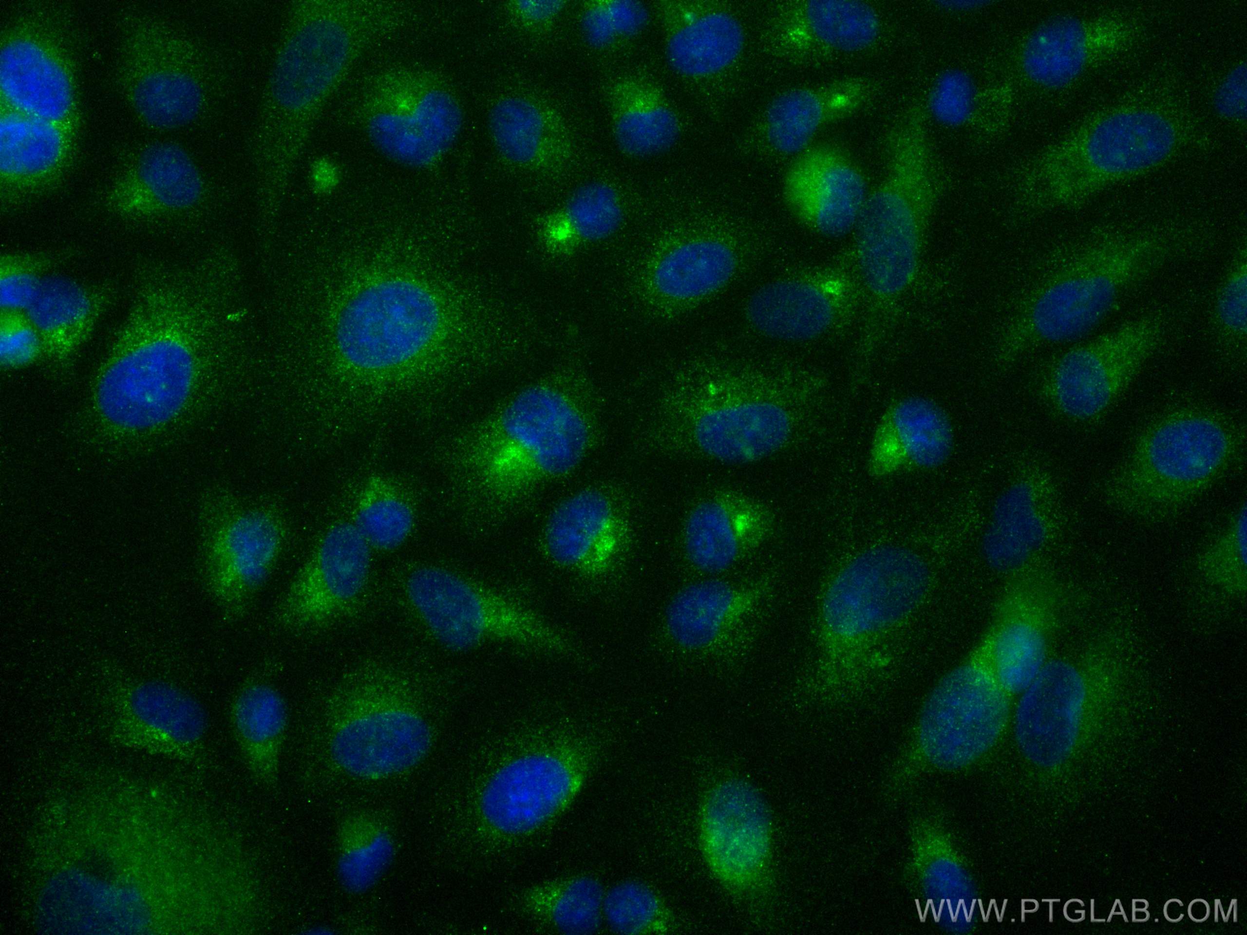 Immunofluorescence (IF) / fluorescent staining of A549 cells using DCT Polyclonal antibody (13095-1-AP)