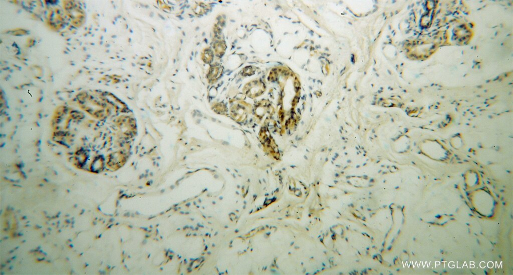 Immunohistochemistry (IHC) staining of human skin tissue using DCT Polyclonal antibody (13095-1-AP)