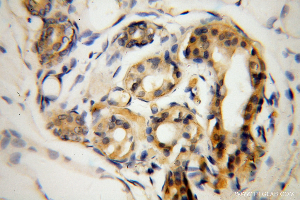 Immunohistochemistry (IHC) staining of human skin tissue using DCT Polyclonal antibody (13095-1-AP)