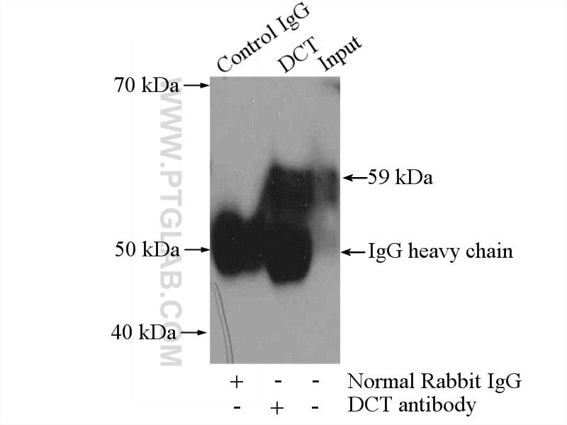 Immunoprecipitation (IP) experiment of HL-60 cells using DCT Polyclonal antibody (13095-1-AP)