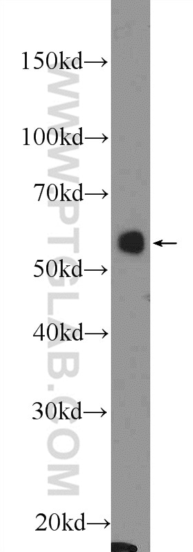 Western Blot (WB) analysis of rat skin tissue using DCT Polyclonal antibody (13095-1-AP)