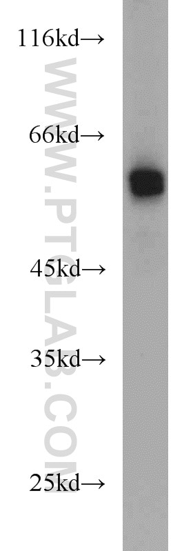 Western Blot (WB) analysis of A375 cells using DCT Polyclonal antibody (13095-1-AP)