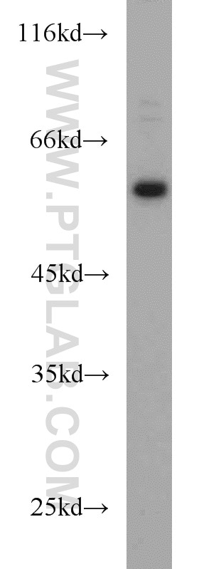 Western Blot (WB) analysis of A431 cells using DCT Polyclonal antibody (13095-1-AP)