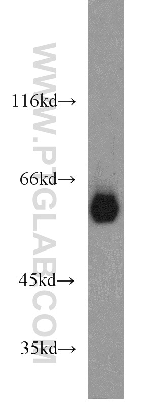 Western Blot (WB) analysis of HL-60 cells using DCT Polyclonal antibody (13095-1-AP)