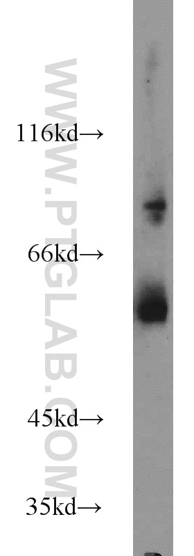 Western Blot (WB) analysis of COS-7 cells using DCT Polyclonal antibody (13095-1-AP)