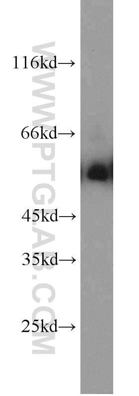Western Blot (WB) analysis of MCF-7 cells using DCT Polyclonal antibody (13095-1-AP)