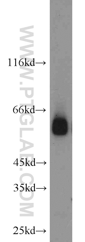 Western Blot (WB) analysis of HL-60 cells using DCT Polyclonal antibody (13095-1-AP)
