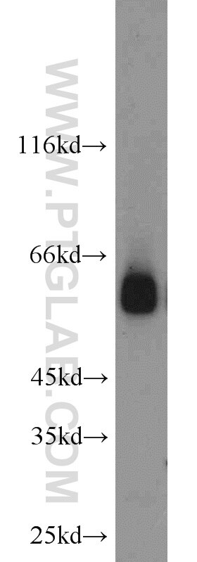 WB analysis of HL-60 using 13095-1-AP