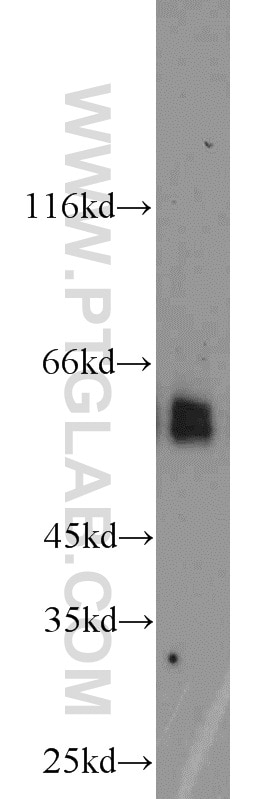 Western Blot (WB) analysis of HL-60 cells using DCT Polyclonal antibody (13095-1-AP)