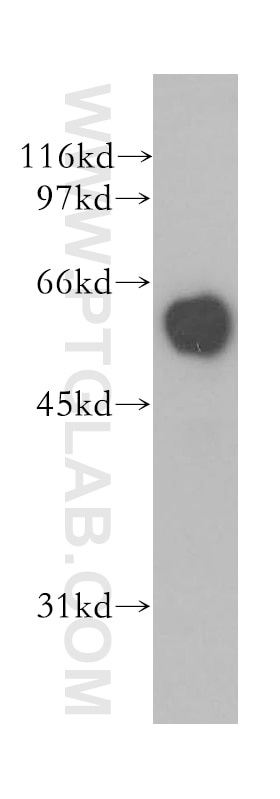 Western Blot (WB) analysis of A431 cells using DCT Polyclonal antibody (13095-1-AP)