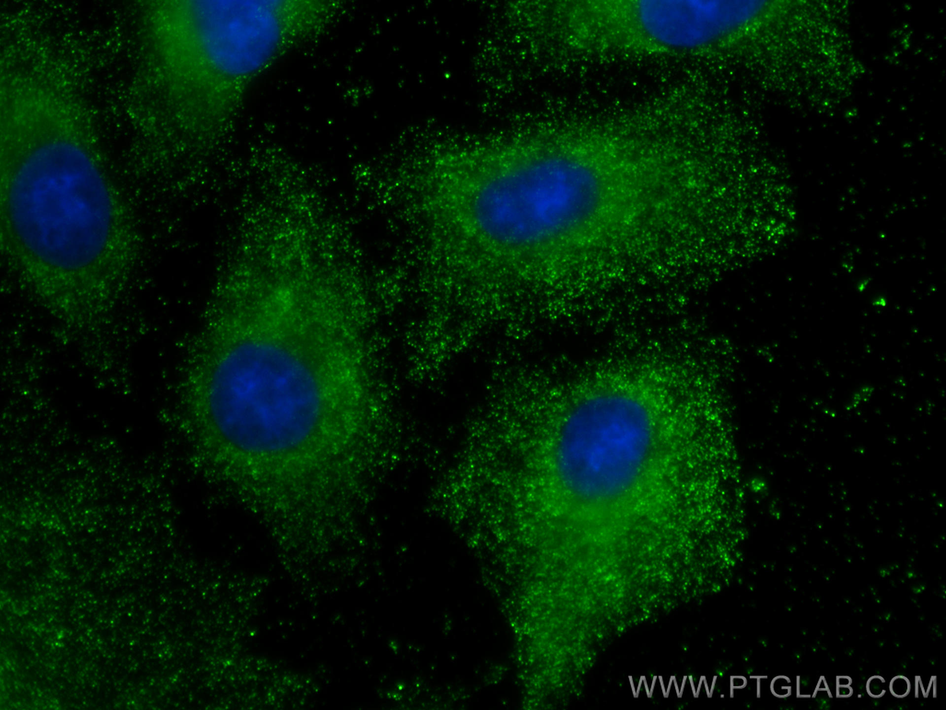 Immunofluorescence (IF) / fluorescent staining of A549 cells using DCT Monoclonal antibody (68114-1-Ig)