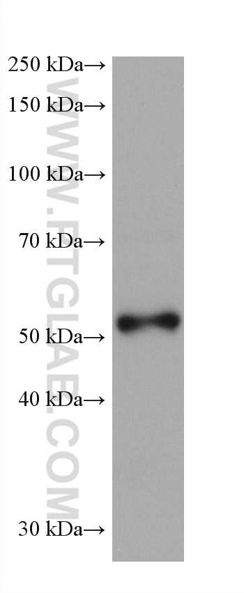 Western Blot (WB) analysis of pig skin tissue using DCT Monoclonal antibody (68114-1-Ig)