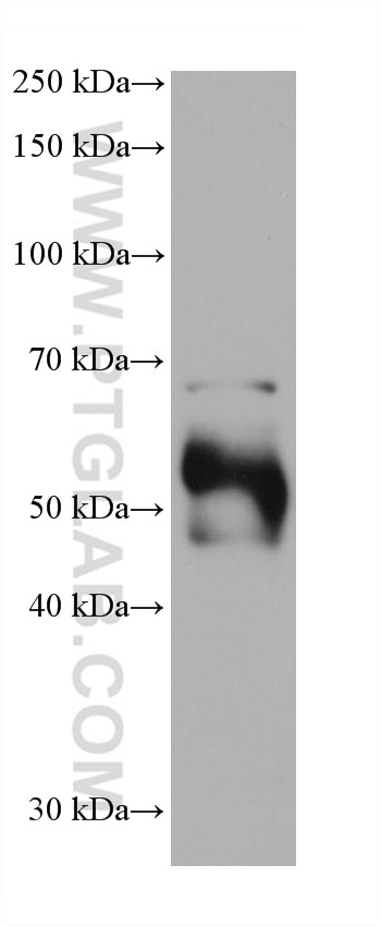 Western Blot (WB) analysis of mouse skin tissue using DCT Monoclonal antibody (68114-1-Ig)