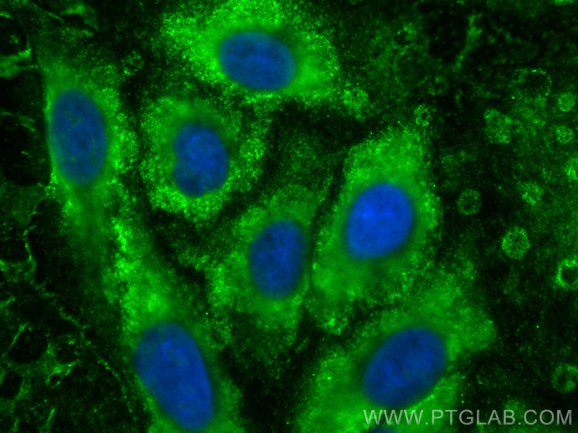 IF Staining of A549 using CL488-68114