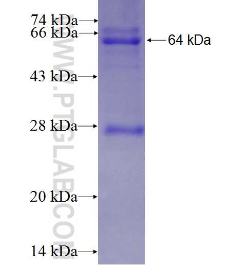 DCT fusion protein Ag3714 SDS-PAGE