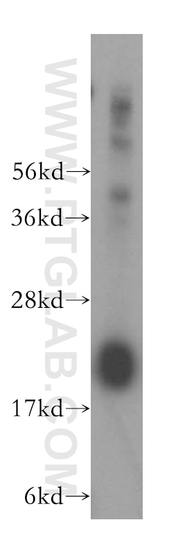 Western Blot (WB) analysis of human brain tissue using DCTD Polyclonal antibody (16784-1-AP)