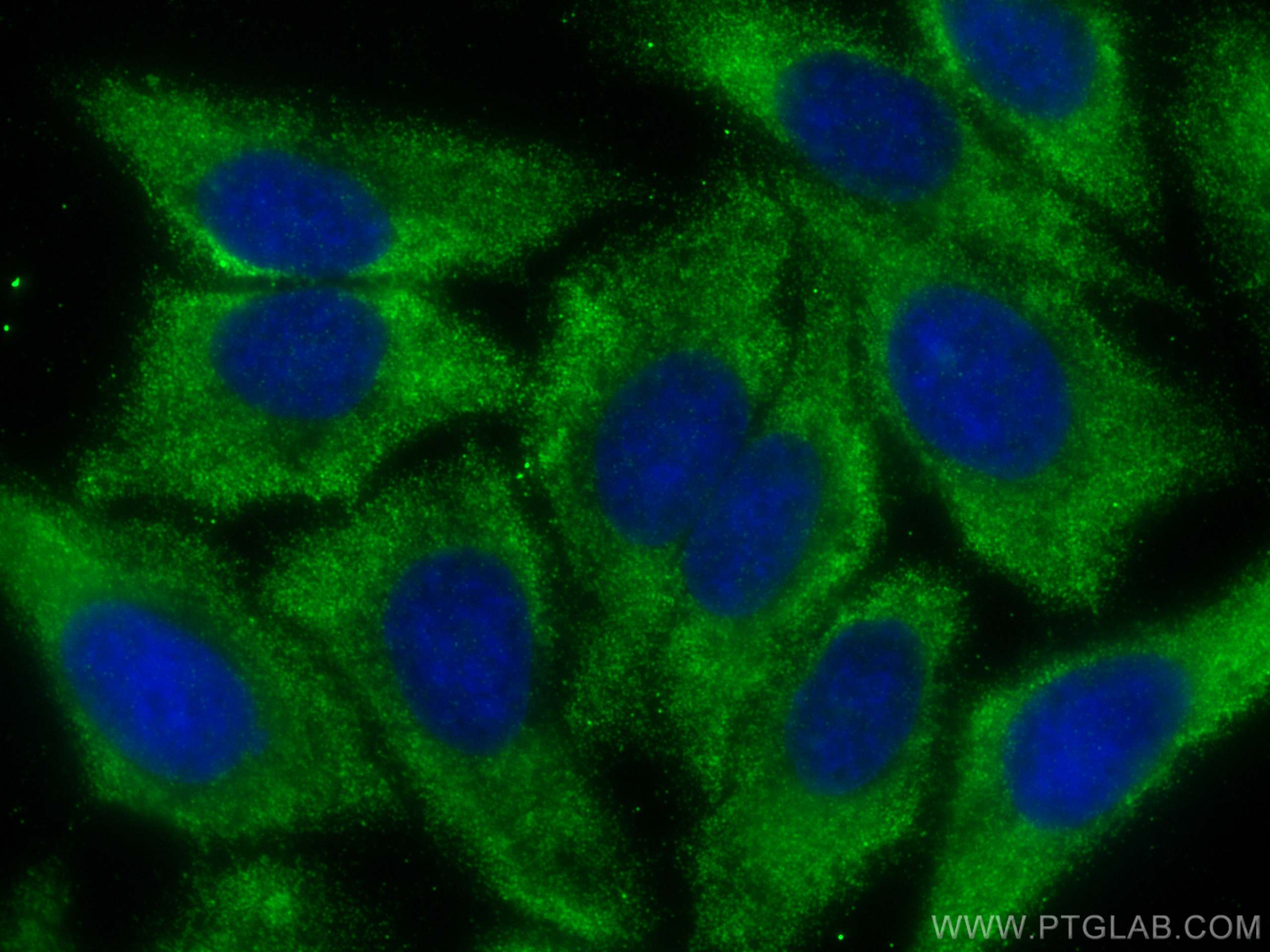 Immunofluorescence (IF) / fluorescent staining of HepG2 cells using DCTD Monoclonal antibody (68357-1-Ig)