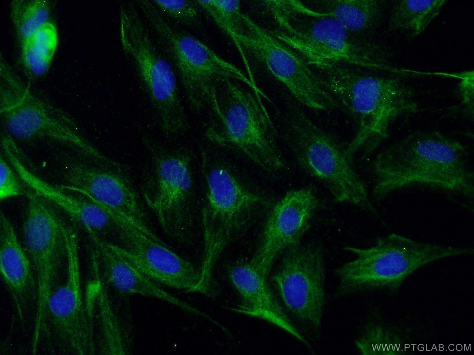 Immunofluorescence (IF) / fluorescent staining of MDCK cells using p150 glued Polyclonal antibody (55182-1-AP)