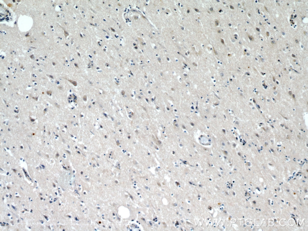 Immunohistochemistry (IHC) staining of human brain tissue using p150 glued Polyclonal antibody (55182-1-AP)