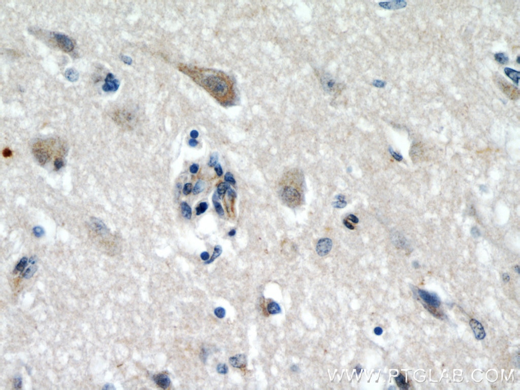 IHC staining of human brain using 55182-1-AP