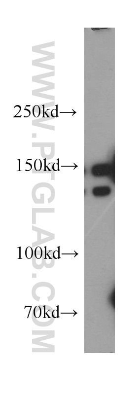 Western Blot (WB) analysis of human brain tissue using p150 glued Polyclonal antibody (55182-1-AP)