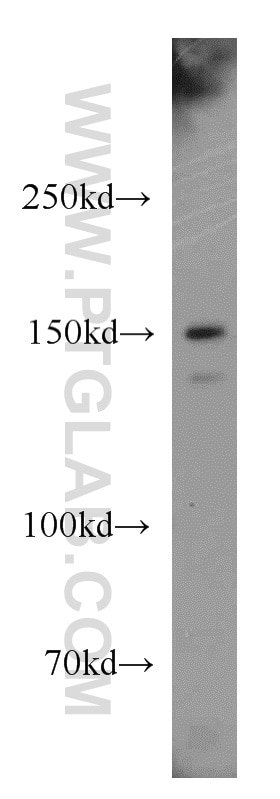Western Blot (WB) analysis of Jurkat cells using p150 glued Polyclonal antibody (55182-1-AP)