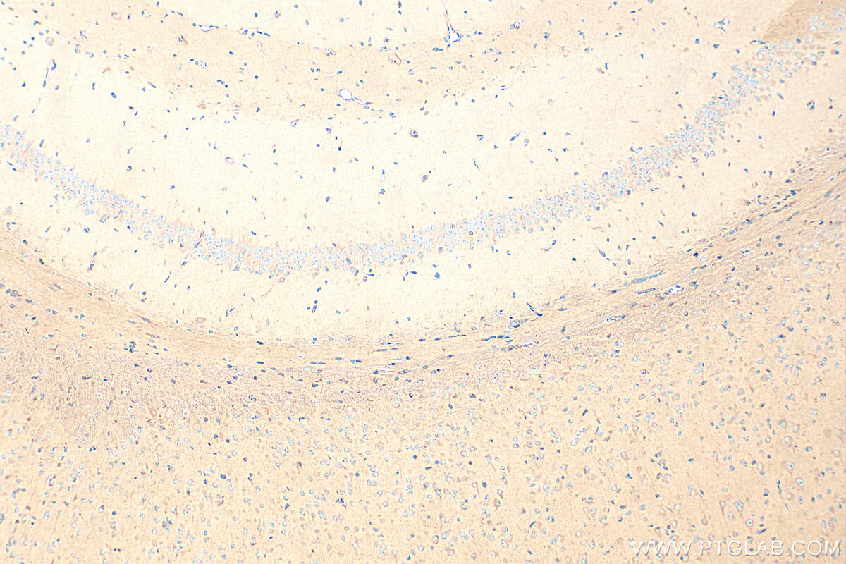 IHC staining of mouse brain using 11325-1-AP Immunohistochemistry (IHC) staining of mouse brain tissue using DCTN3 Polyclonal antibody (11325-1-AP)