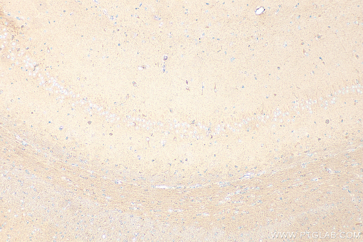 IHC staining of rat brain using 11325-1-AP Immunohistochemistry (IHC) staining of rat brain tissue using DCTN3 Polyclonal antibody (11325-1-AP)