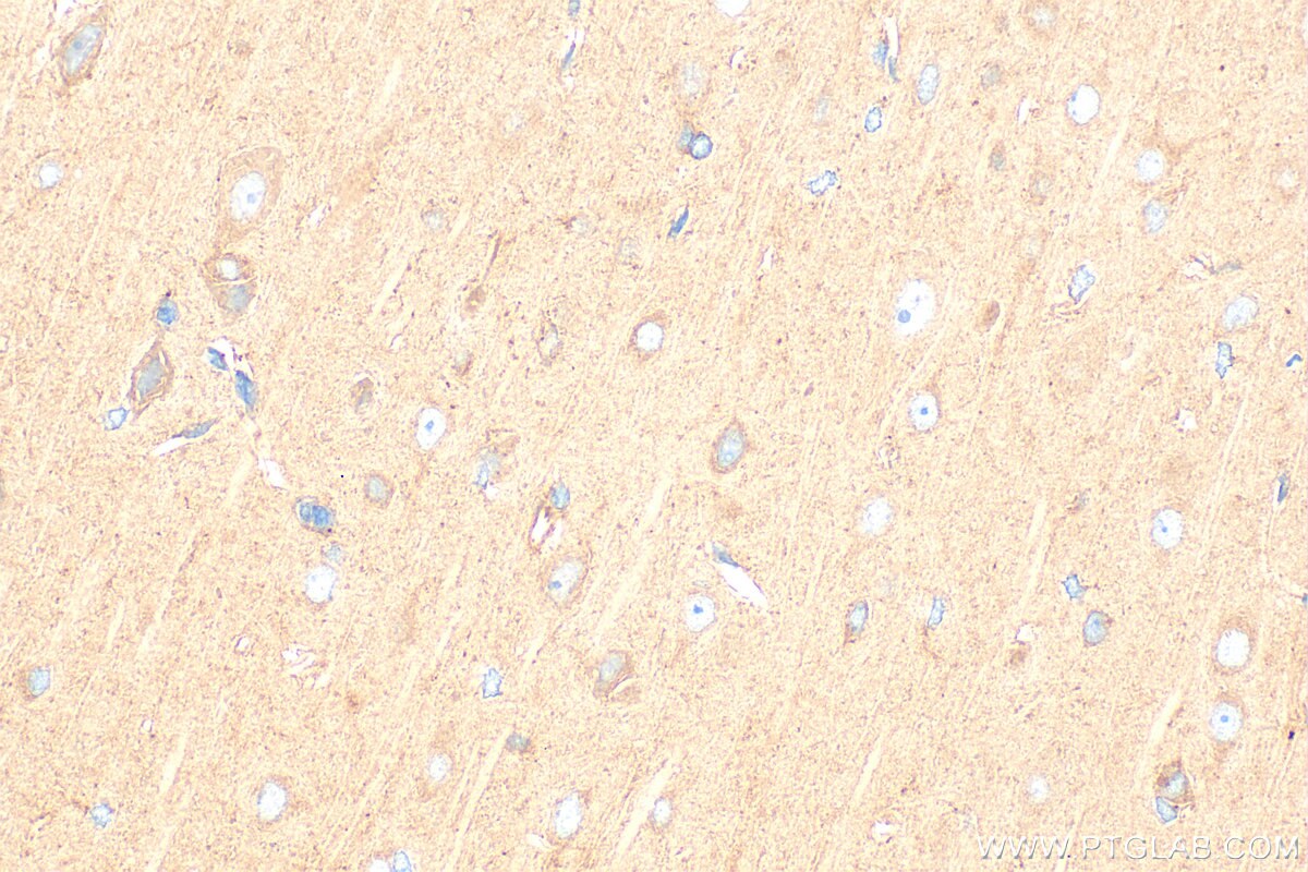 IHC staining of rat brain using 11325-1-AP Immunohistochemistry (IHC) staining of rat brain tissue using DCTN3 Polyclonal antibody (11325-1-AP)