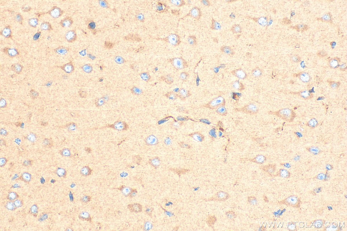 IHC staining of mouse brain using 11325-1-AP Immunohistochemistry (IHC) staining of mouse brain tissue using DCTN3 Polyclonal antibody (11325-1-AP)
