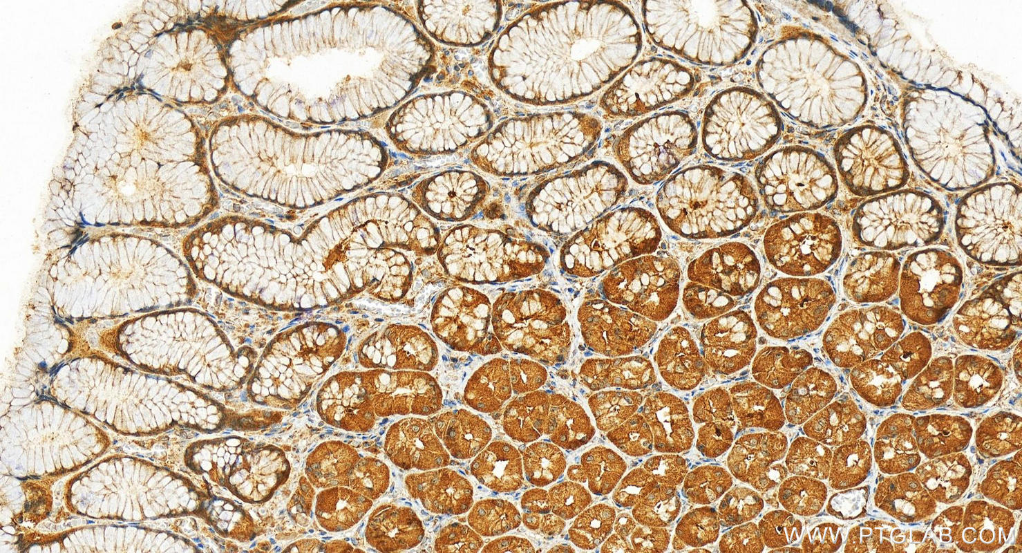 Immunohistochemistry (IHC) staining of human stomach tissue using DCTN4 Polyclonal antibody (17098-1-AP)