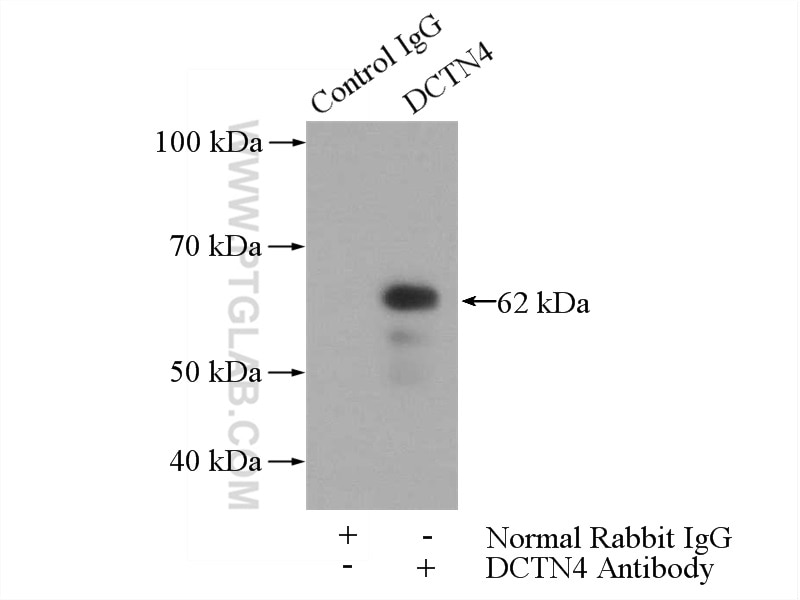 Immunoprecipitation (IP) experiment of Jurkat cells using DCTN4 Polyclonal antibody (17098-1-AP)