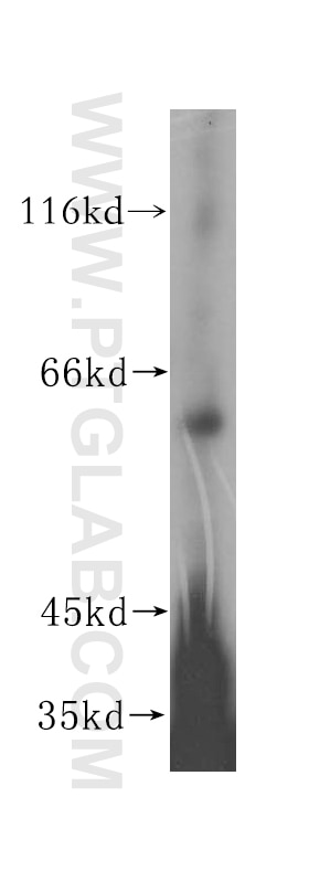 WB analysis of HepG2 using 17098-1-AP