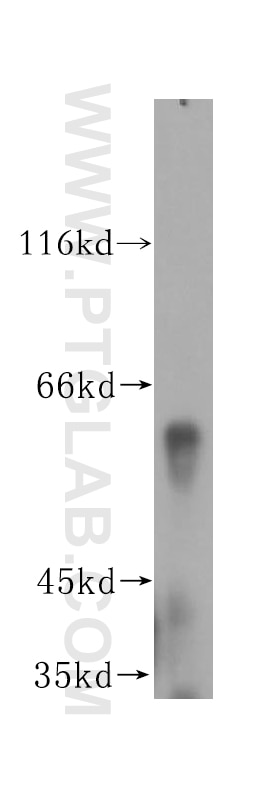 Western Blot (WB) analysis of human brain tissue using DCTN4 Polyclonal antibody (17098-1-AP)