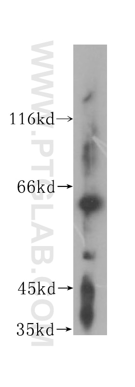 Western Blot (WB) analysis of Jurkat cells using DCTN4 Polyclonal antibody (17098-1-AP)