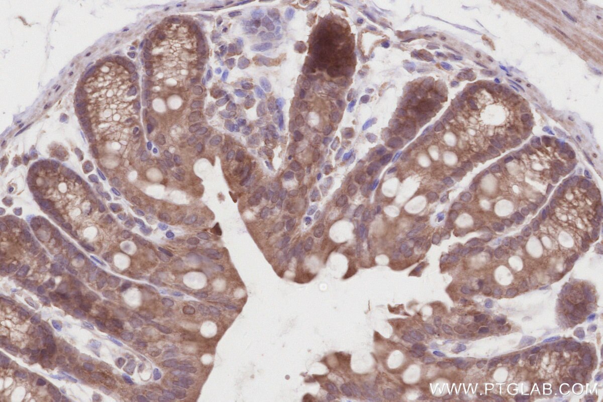 Immunohistochemistry (IHC) staining of mouse colon tissue using DCTN5 Polyclonal antibody (10182-1-AP)