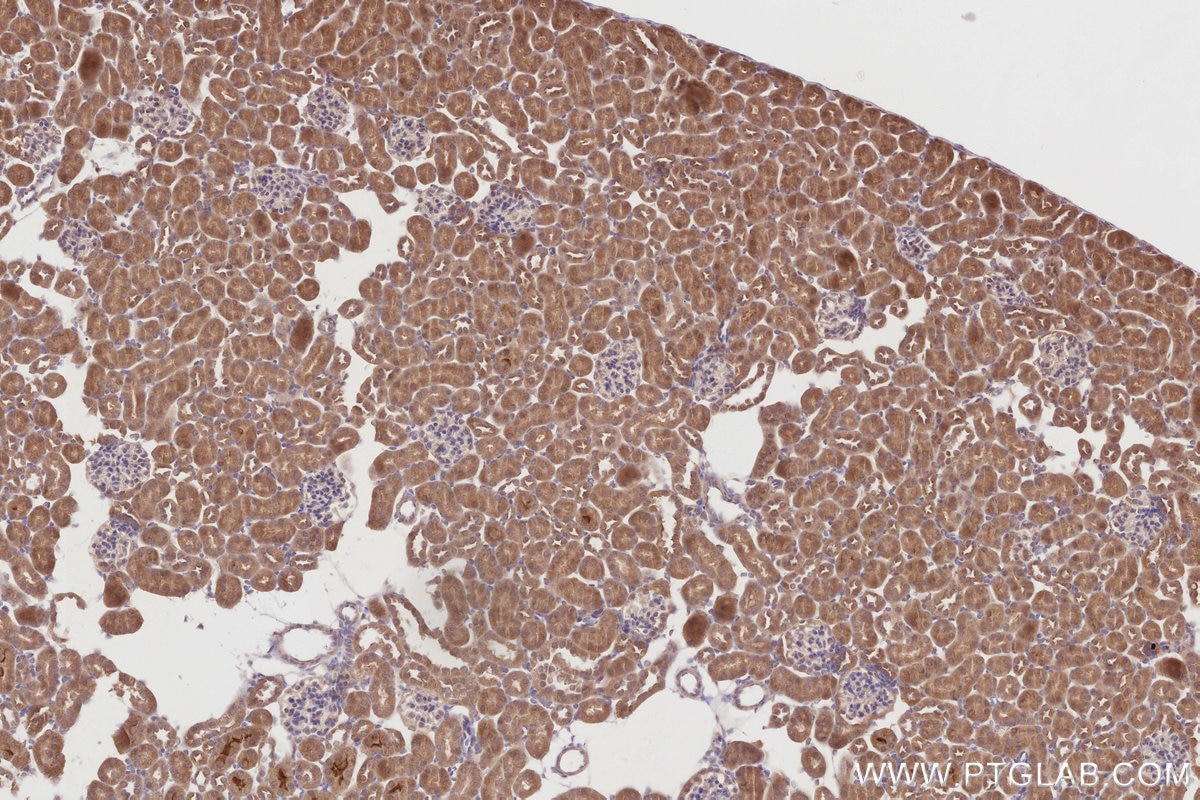 Immunohistochemistry (IHC) staining of mouse kidney tissue using DCTN5 Polyclonal antibody (10182-1-AP)
