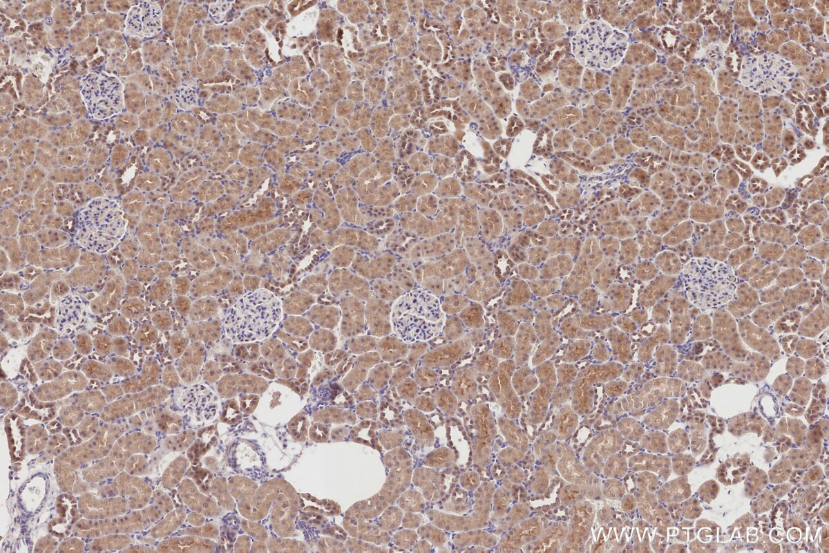 Immunohistochemistry (IHC) staining of rat kidney tissue using DCTN5 Polyclonal antibody (10182-1-AP)