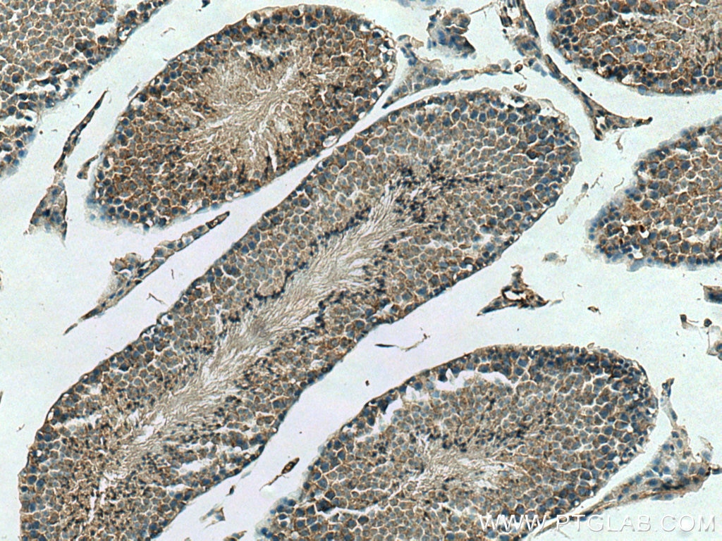 Immunohistochemistry (IHC) staining of mouse testis tissue using DCTN6 Polyclonal antibody (16947-1-AP)