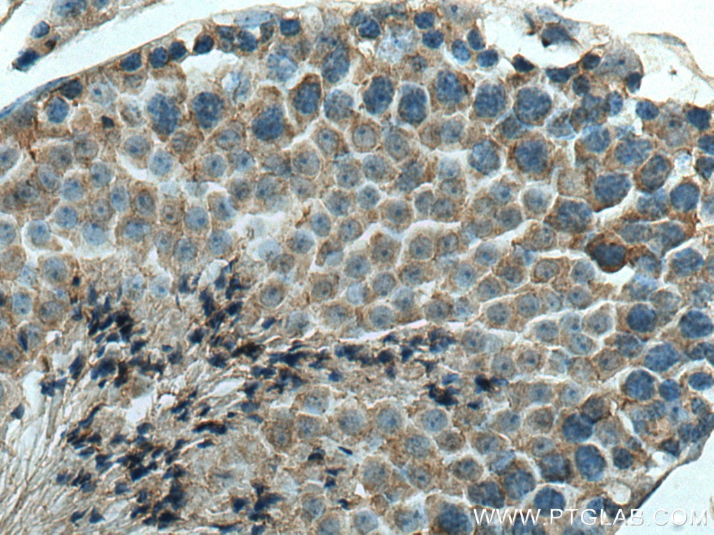 Immunohistochemistry (IHC) staining of mouse testis tissue using DCTN6 Polyclonal antibody (16947-1-AP)