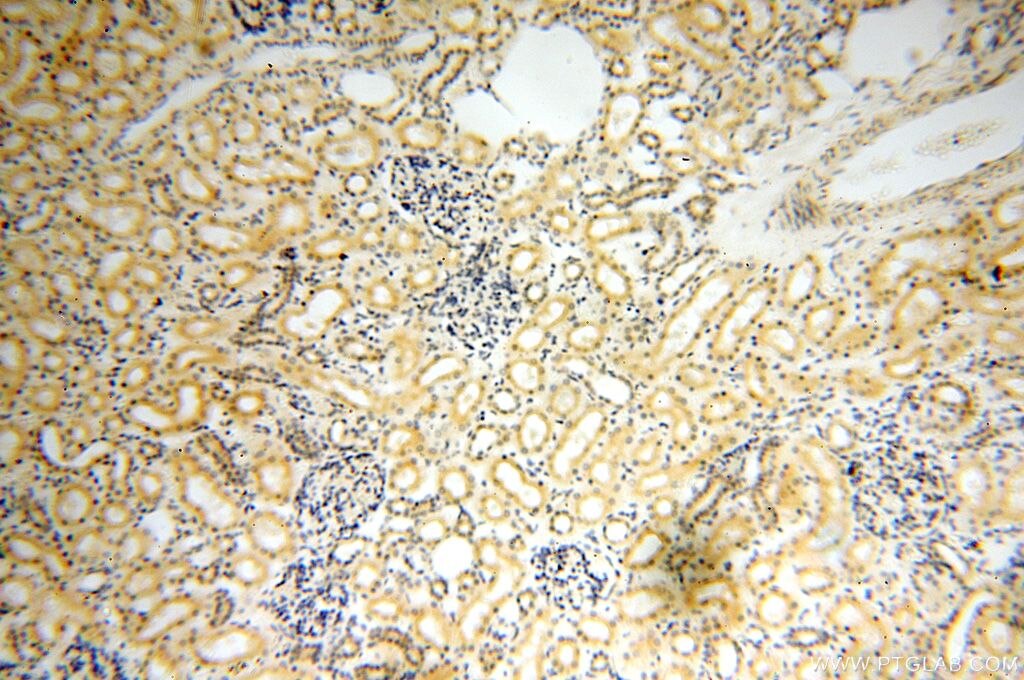 Immunohistochemistry (IHC) staining of human kidney tissue using DCTN6 Polyclonal antibody (16947-1-AP)