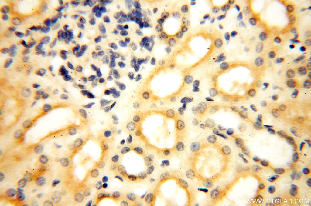 Immunohistochemistry (IHC) staining of human kidney tissue using DCTN6 Polyclonal antibody (16947-1-AP)