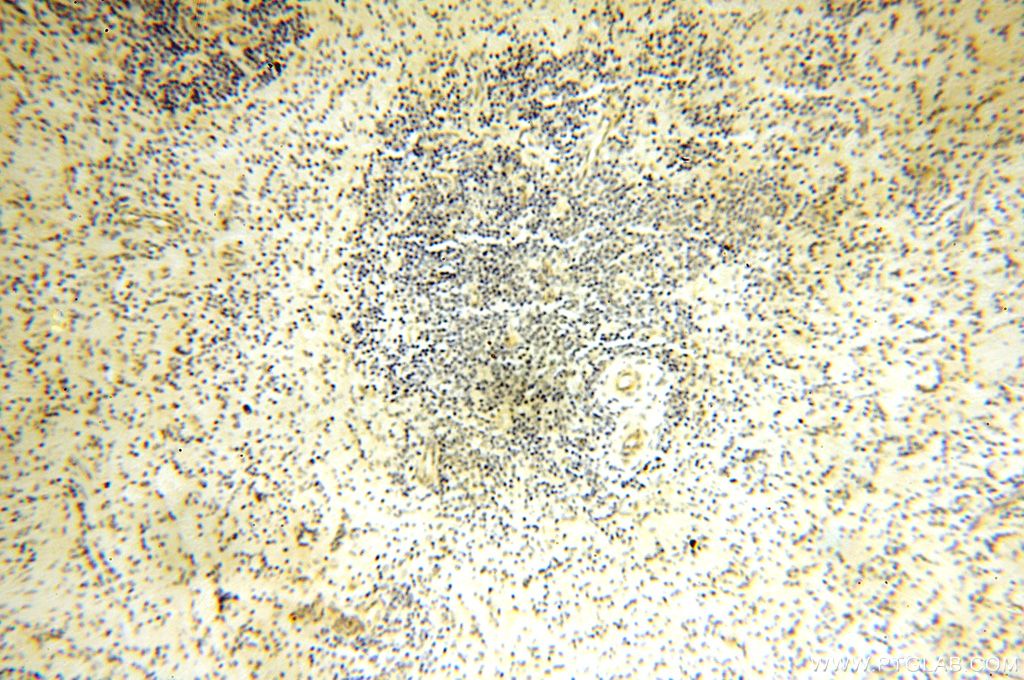 Immunohistochemistry (IHC) staining of human spleen tissue using DCTN6 Polyclonal antibody (16947-1-AP)
