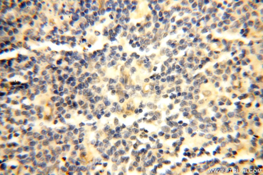 Immunohistochemistry (IHC) staining of human spleen tissue using DCTN6 Polyclonal antibody (16947-1-AP)