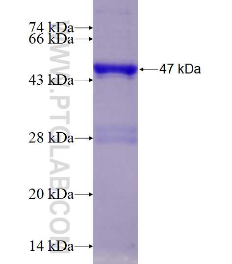 DCTN6 fusion protein Ag10561 SDS-PAGE