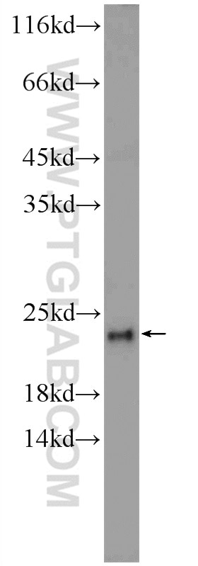 Western Blot (WB) analysis of HeLa cells using DCTPP1 Polyclonal antibody (16684-1-AP)