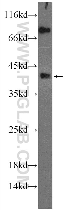 Western Blot (WB) analysis of mouse heart tissue using DCTPP1 Polyclonal antibody (16684-1-AP)