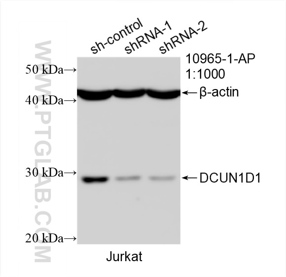 Western Blot (WB) analysis of Jurkat cells using DCUN1D1 Polyclonal antibody (10965-1-AP)